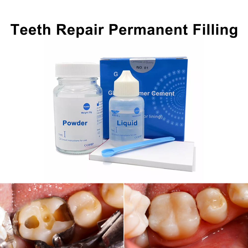 Teeth Whitening At Home Kit - Permanent Teeth Filling Repair Kit At