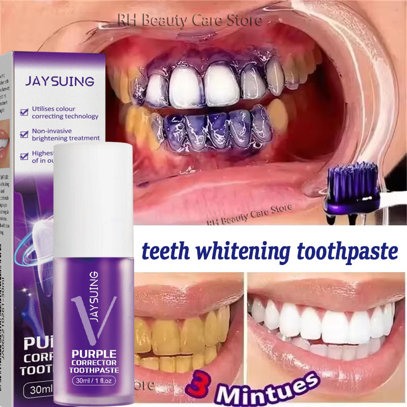 Teeth Whitening In Korea - Teeth Cleansing Whitening Toothpaste Whiten Gel
