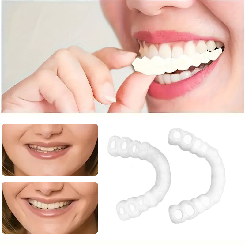 Teeth Whitening With Braces - On Smile Dental Upper Lower Fake