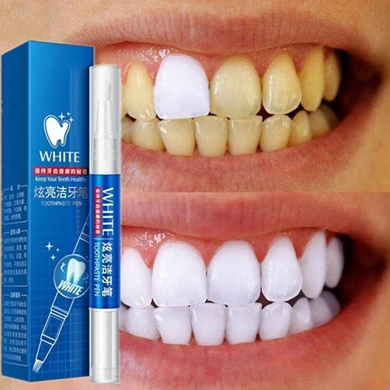50 ML Teeth Whitening Stain Re - đánh giá và giá Teeth Whitening Pen