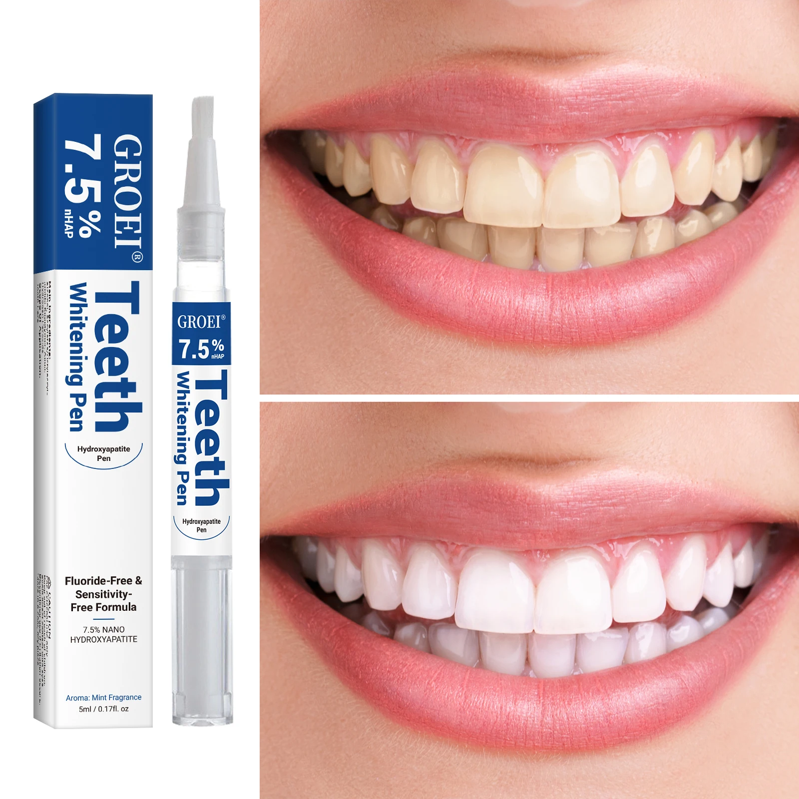 Hydroxyapatite Tooth Whitening - đánh giá và giá Teeth Whitening Pen