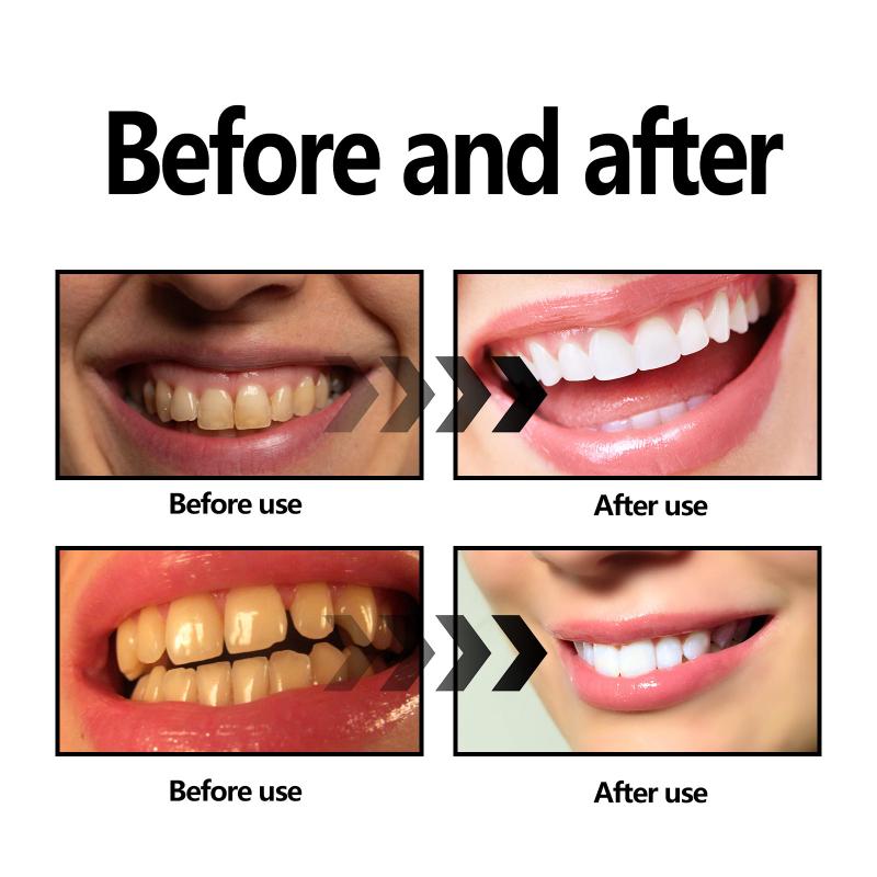 Teeth Whitening Powder Charcoa - đánh giá và giá Teeth Whitening Baking Soda