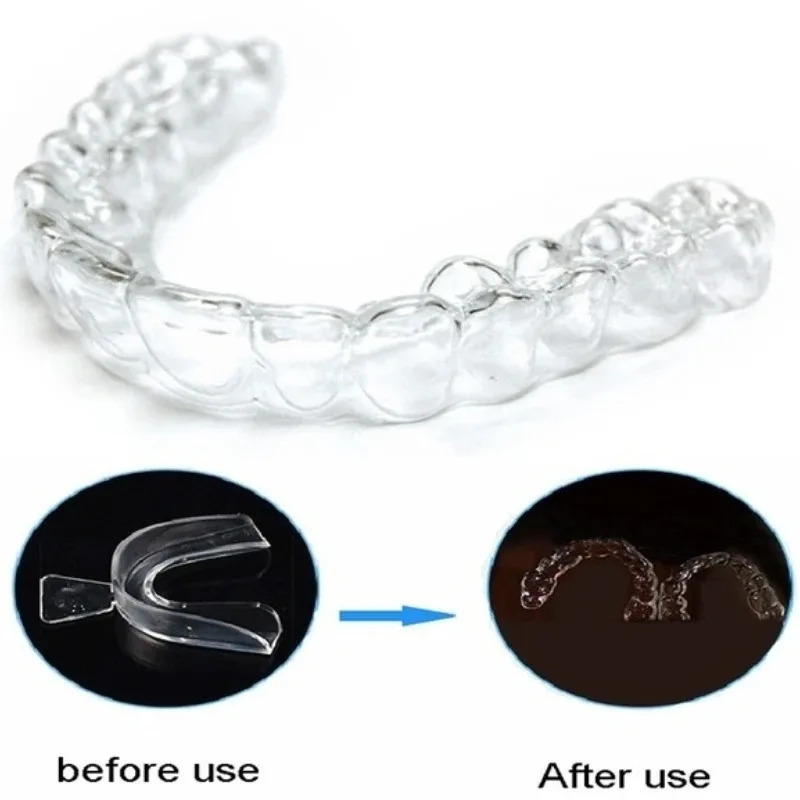 1/3/6pairs Silicone Mouth Guar - đánh giá và giá Teeth Whitening With Braces