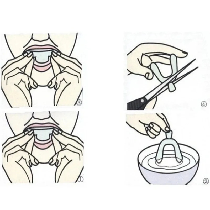 1/3/6pairs Silicone Mouth Guar - đánh giá và giá Teeth Whitening With Braces