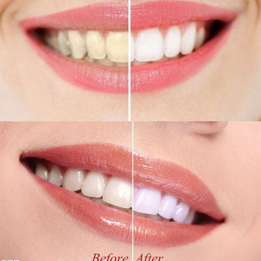 Bamboo Charcoal Teeth Tooth De - đánh giá và giá Teeth Whitening Results