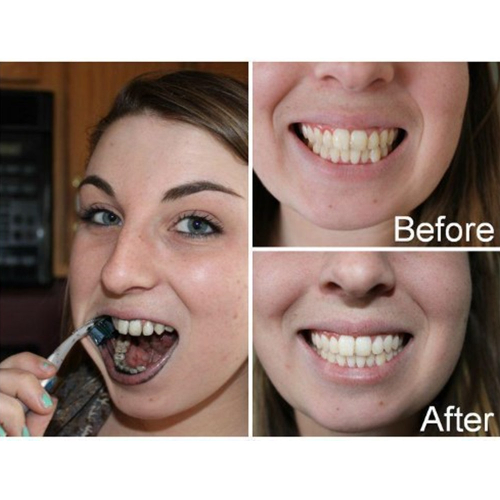Bamboo Charcoal Teeth Tooth De - đánh giá và giá Teeth Whitening Results