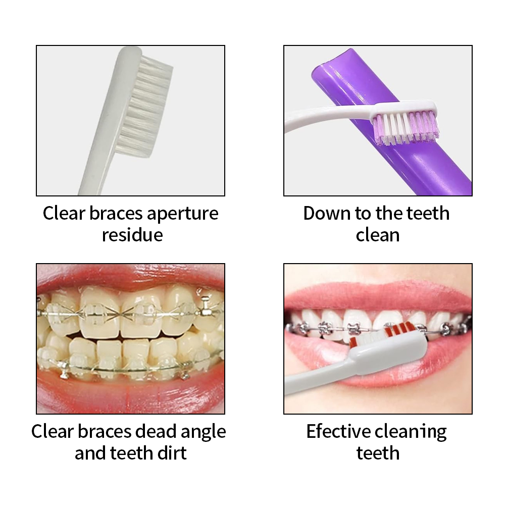 8Pcs/set Orthodontic Dental Ca - đánh giá và giá Teeth Whitening With Braces