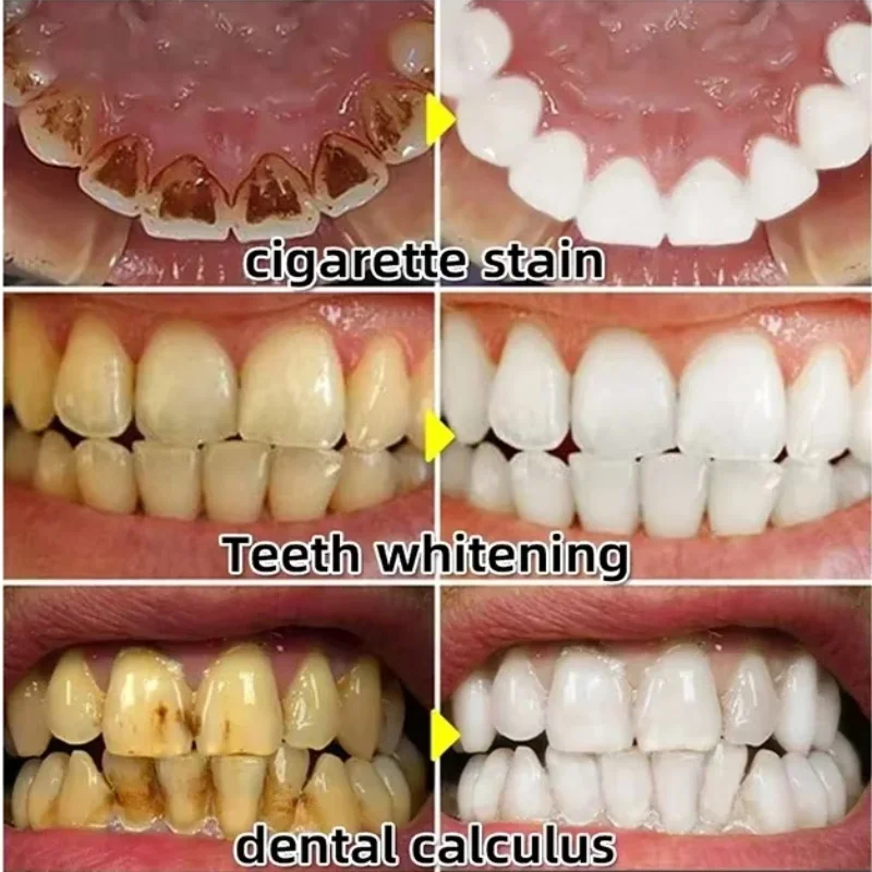 Quickly Repair Gum Serum Relie - đánh giá và giá Teeth Whitening Baking Soda