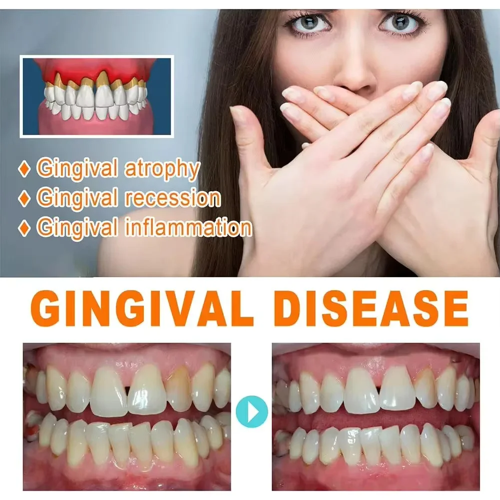 Quickly Repair Gum Serum Relie - đánh giá và giá Teeth Whitening Baking Soda