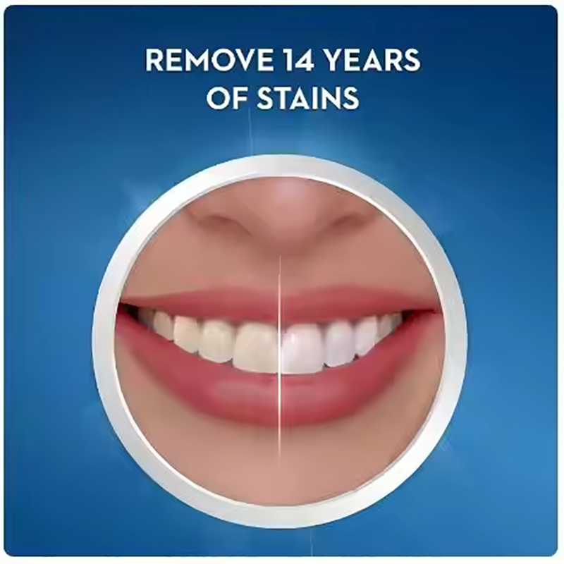 Crest White Teeth Whitening St - đánh giá và giá Teeth Whitening Effects