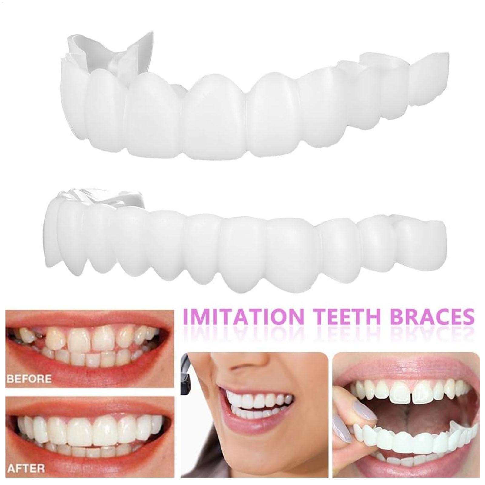 Dental Upper Lower Fake Teeth  - đánh giá và giá Teeth Whitening With Braces