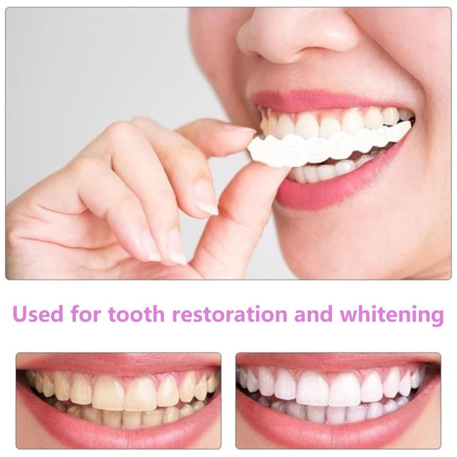 Dental Upper Lower Fake Teeth  - đánh giá và giá Teeth Whitening With Braces