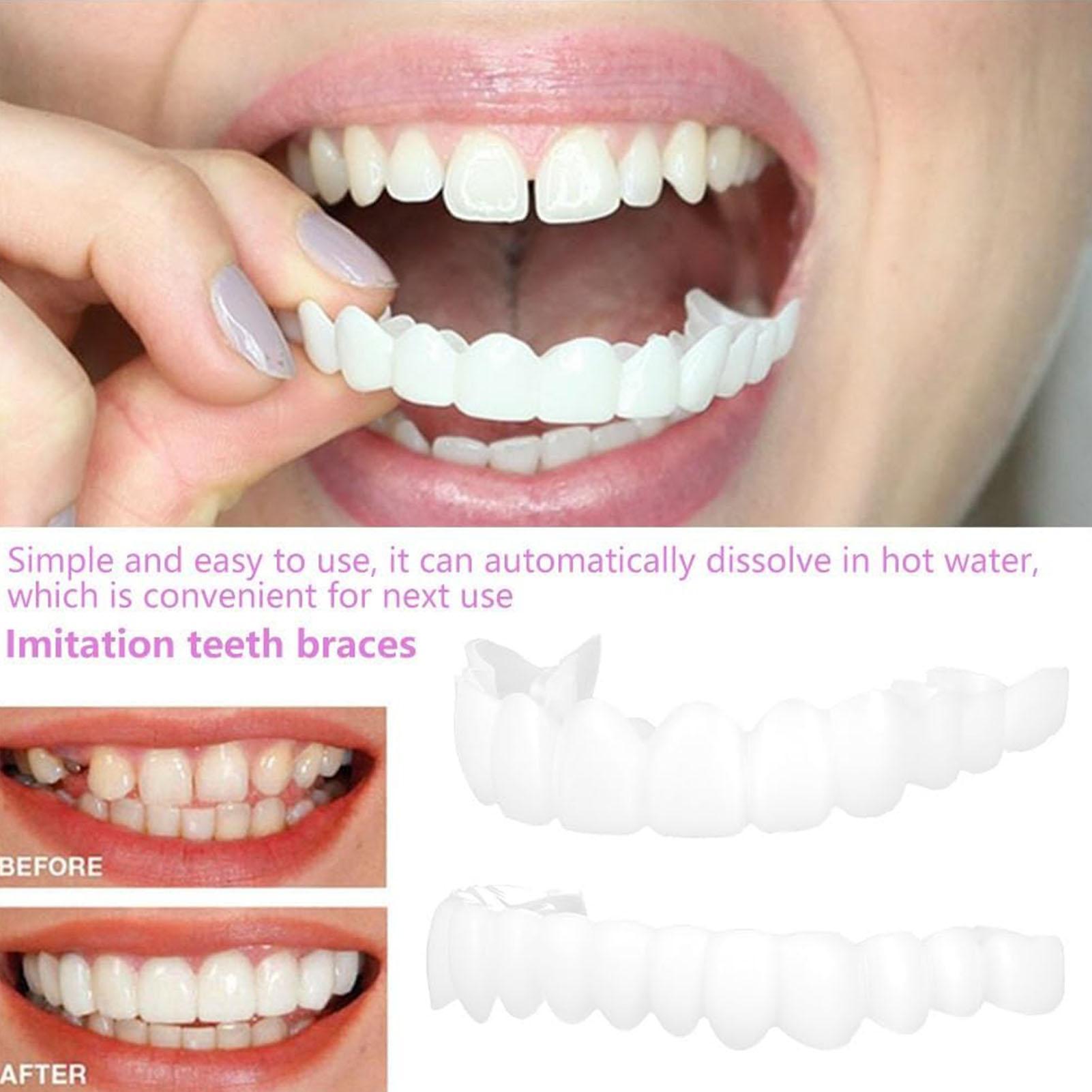 Dental Upper Lower Fake Teeth  - đánh giá và giá Teeth Whitening With Braces