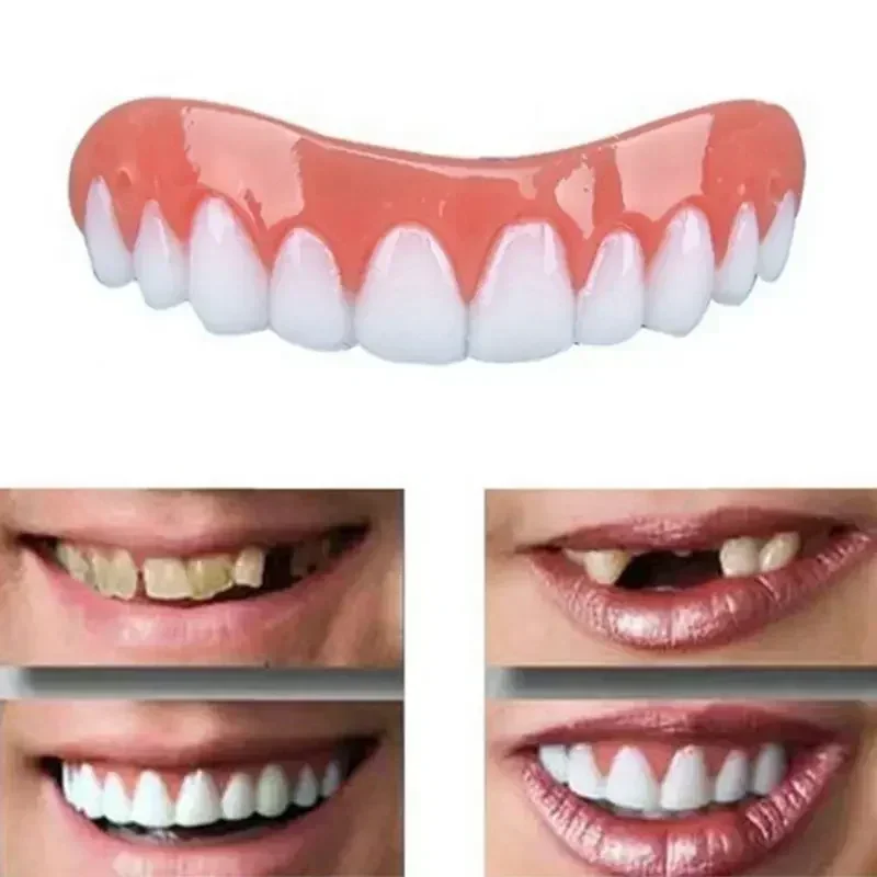 New False Teeth Silicone Upper - đánh giá và giá Teeth Whitening With Braces