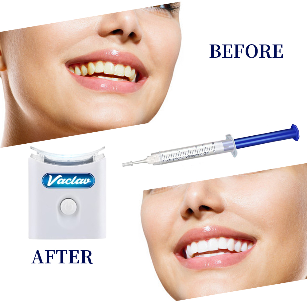 Mint Teeth Whitening Gel Syrin - đánh giá và giá Teeth Whitening Baking Soda