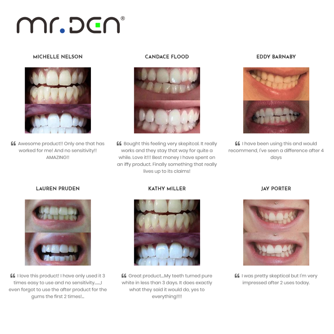 Dr. Whiten 3 Pack Teeth Whiten - đánh giá và giá Teeth Whitening Kit Professional