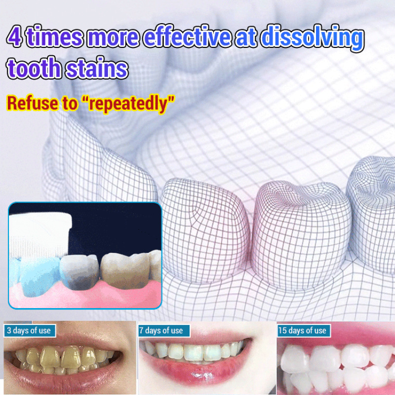 Baking Soda Whiten Teeth Fresh - đánh giá và giá Teeth Whitening Baking Soda