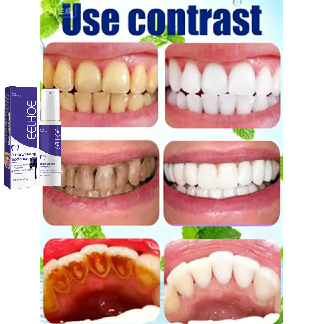 Teeth Cleansing Whitening Toot - đánh giá và giá Teeth Whitening In Korea