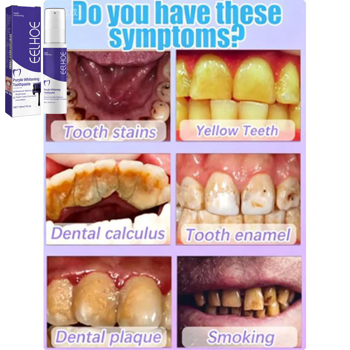 Teeth Cleansing Whitening Toot - đánh giá và giá Teeth Whitening In Korea