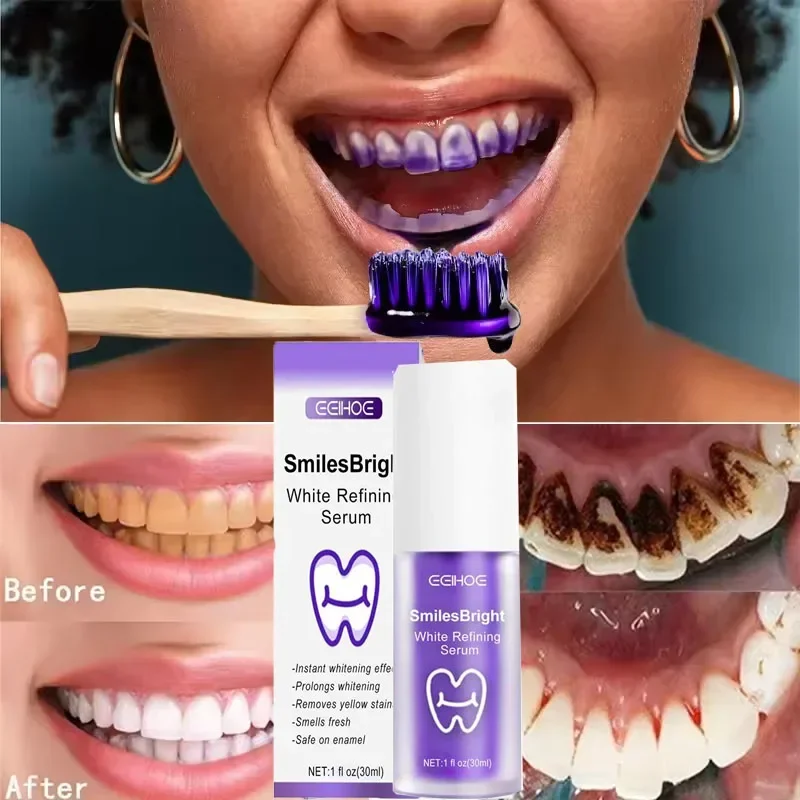 Teeth Cleansing Whitening Toot - đánh giá và giá Teeth Whitening In Korea
