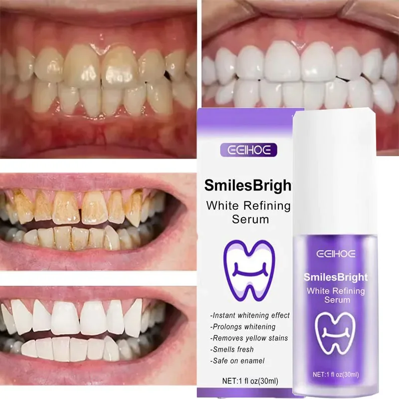 Teeth Cleansing Whitening Toot - đánh giá và giá Teeth Whitening In Korea