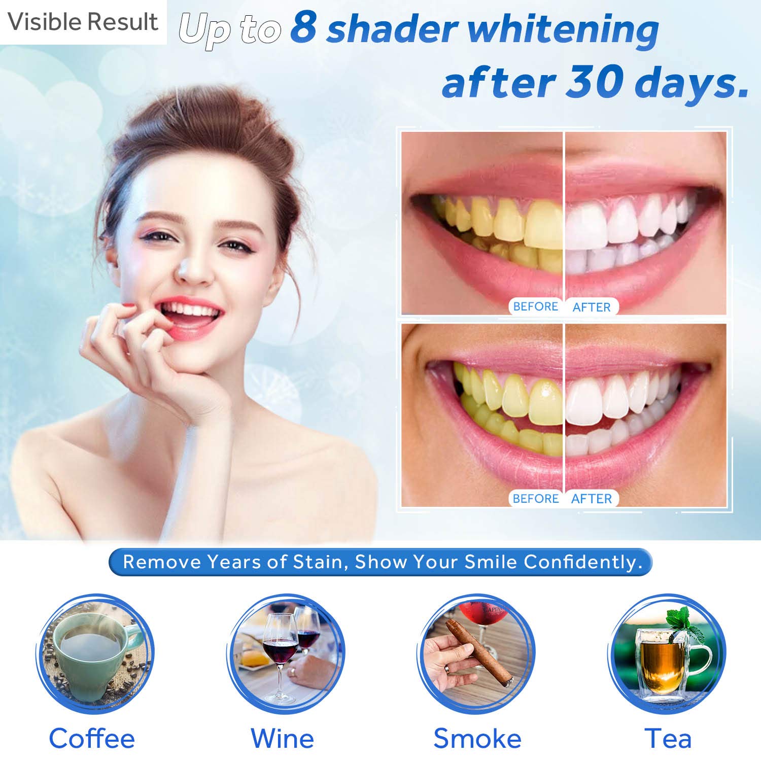 Teeth Whitening Gel Refill Syr - đánh giá và giá Teeth Whitening Results
