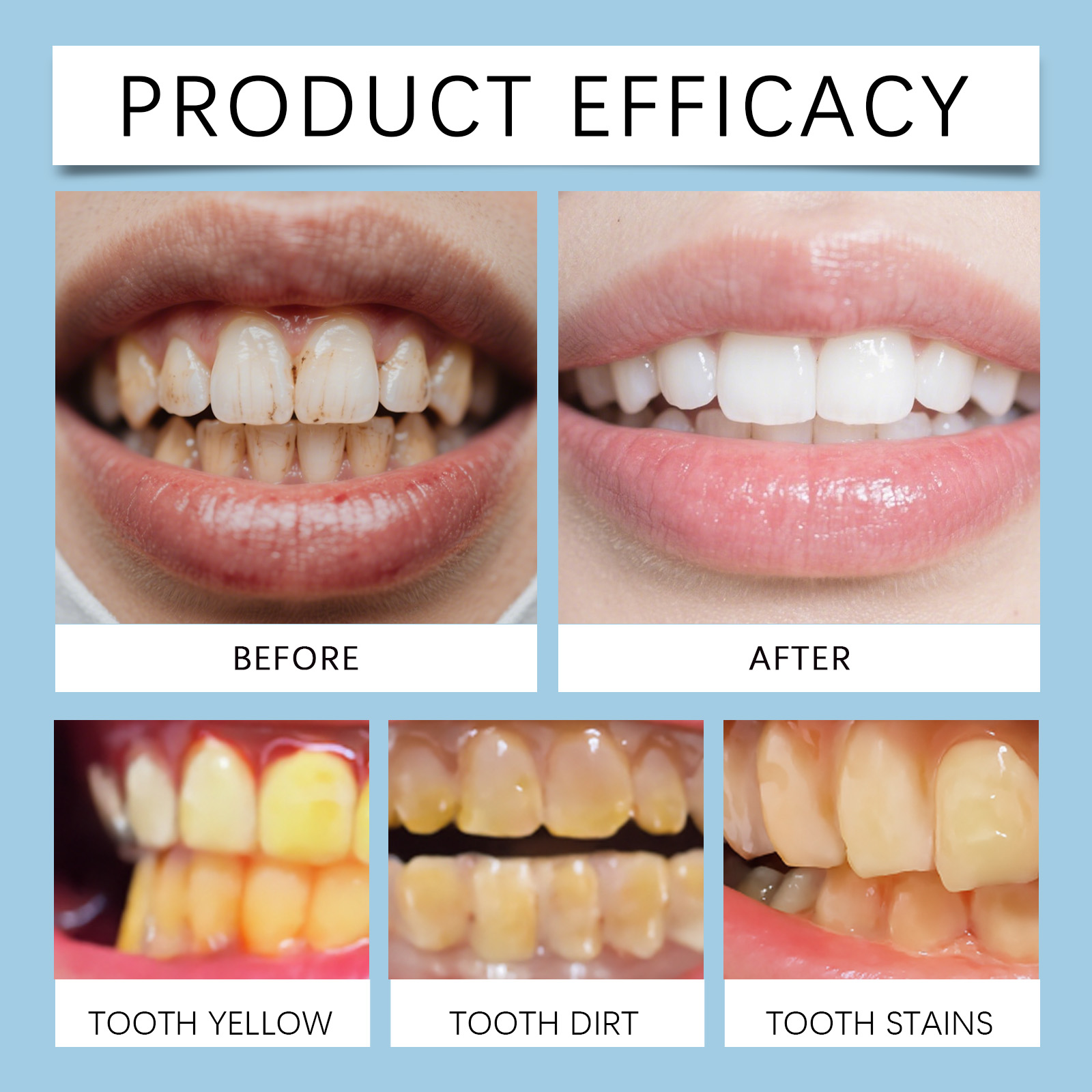 Feimuko 8ml Teeth Gel Pen Gent - đánh giá và giá Teeth Whitening Pen