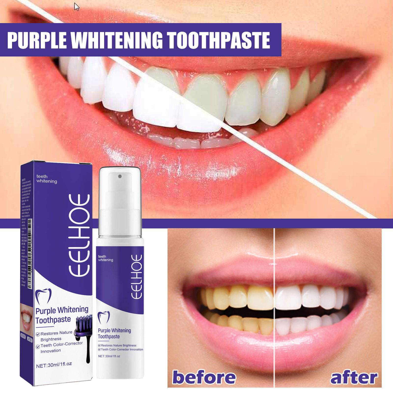 Teeth Cleansing Whitening Toot - đánh giá và giá Teeth Whitening In Korea