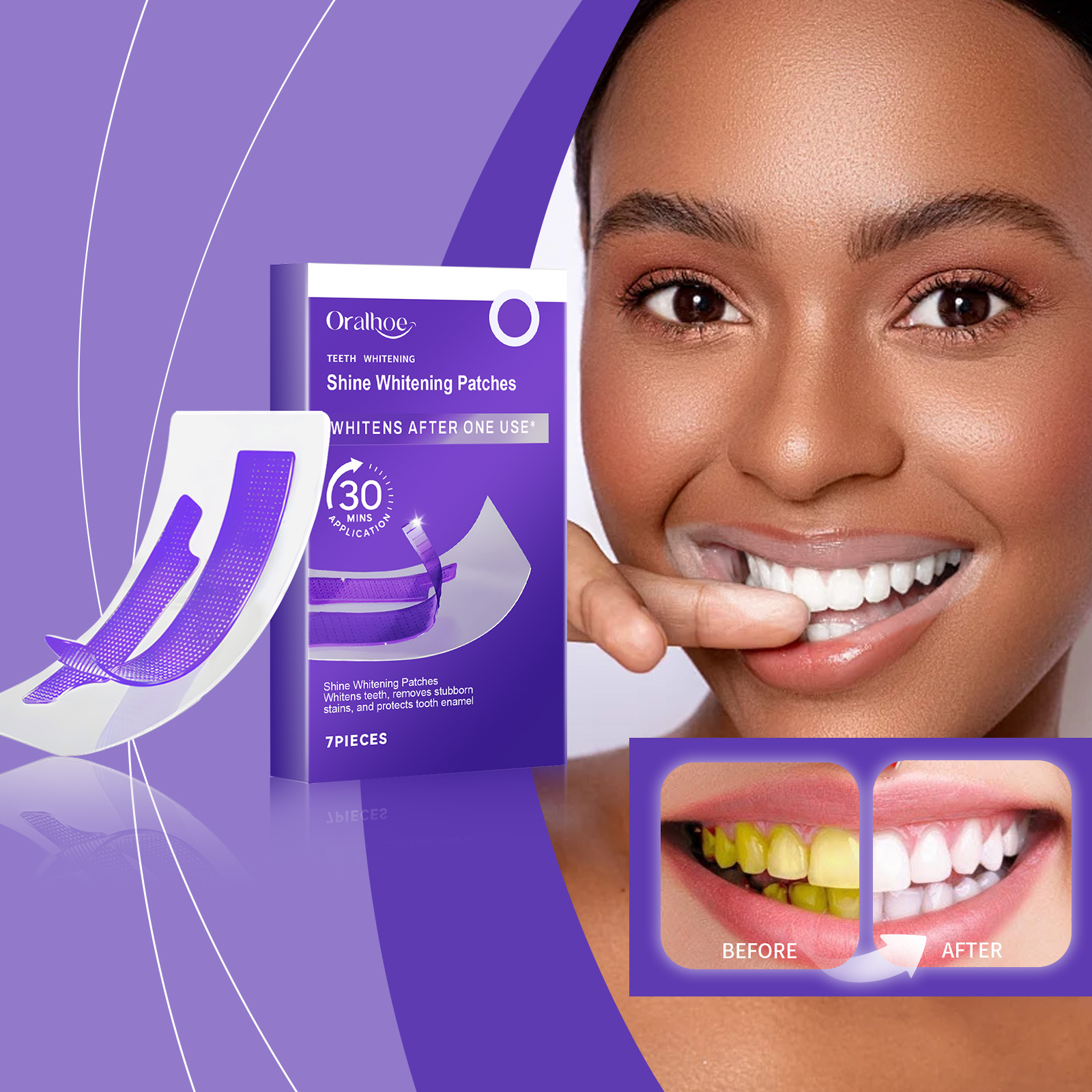 Purple Teeth Whitening Strips  - đánh giá và giá Teeth Whitening Strips Crest