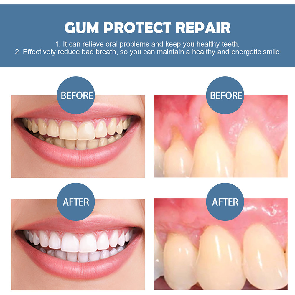 Gum Protection Repair Gel Reli - đánh giá và giá Teeth Whitening Pen