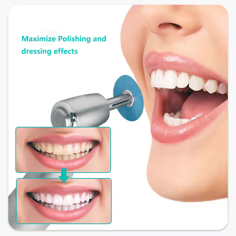 40pcs Dental Polishing Discs H - đánh giá và giá Teeth Whitening Kit Professional