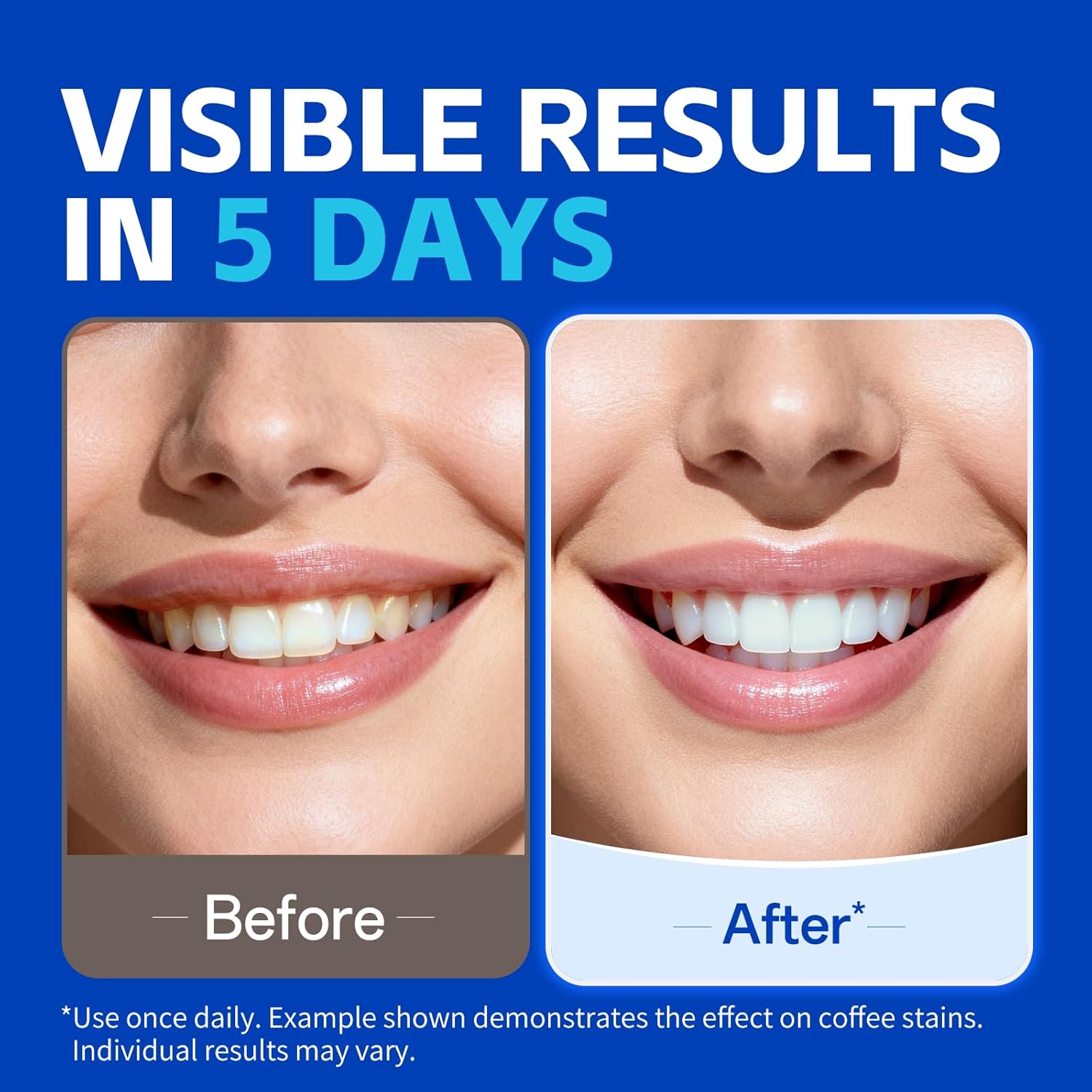 7 pairs Teeth Whitening Strips - đánh giá và giá Teeth Whitening Strips Crest