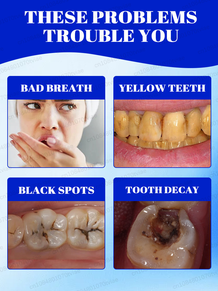 Whitening toothpaste and miner - đánh giá và giá Teeth Whitening Effects