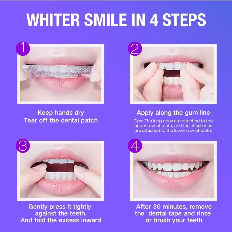 Teeth Whitening Kit - 5X LED L - đánh giá và giá Teeth Whitening Strips Crest
