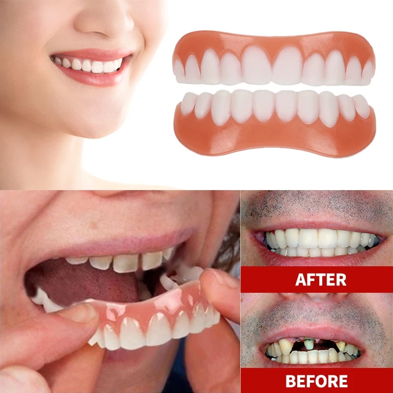 New Denture Silicone Kit Dentu - đánh giá và giá Teeth Whitening With Braces