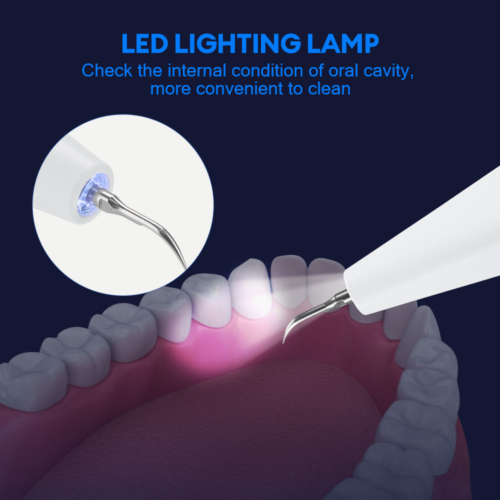 Ultrasonic Dental Calculus Rem - đánh giá và giá Teeth Whitening Kit Professional