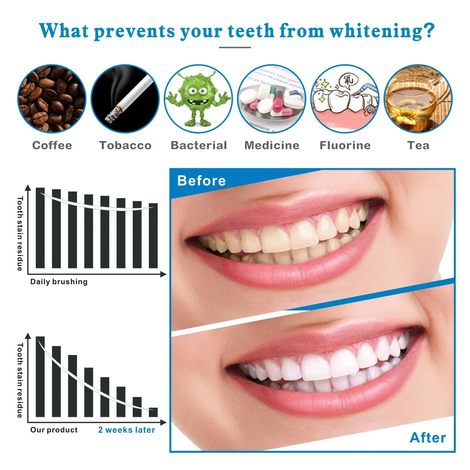 14/28pcs 3D Teeth Whitening St - đánh giá và giá Teeth Whitening Effects
