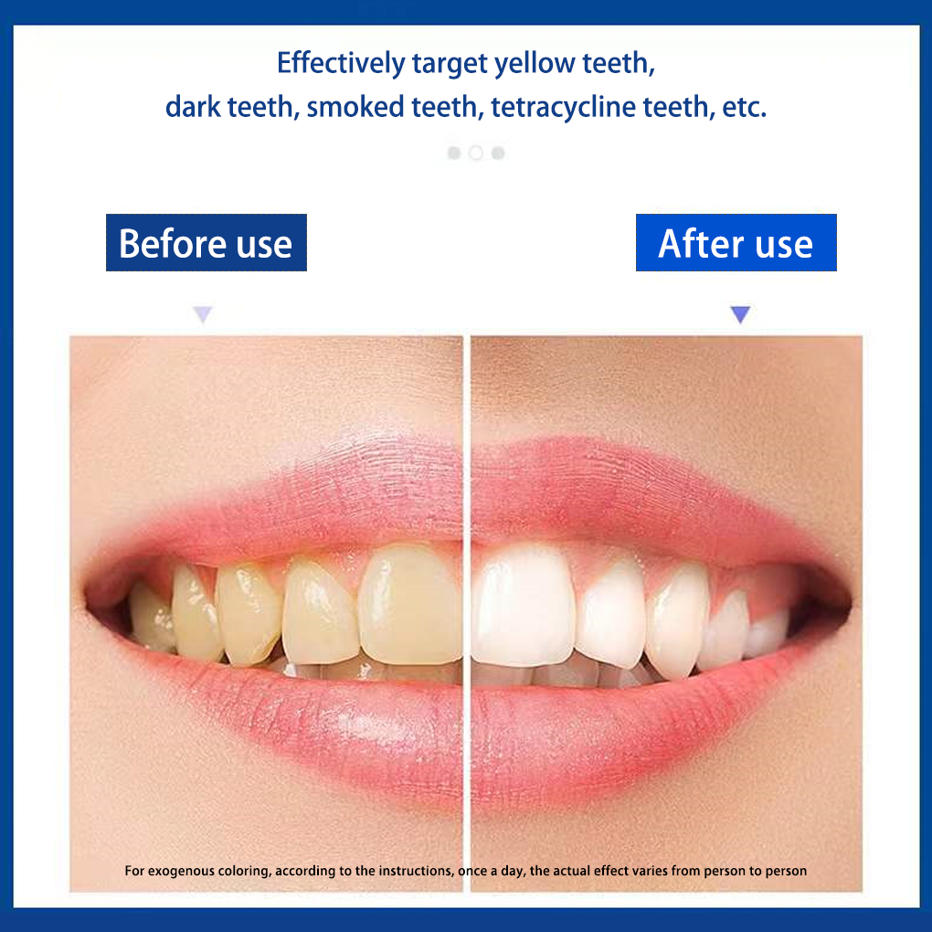 70/140 Pairs 5D White Teeth Wh - đánh giá và giá Teeth Whitening Effects