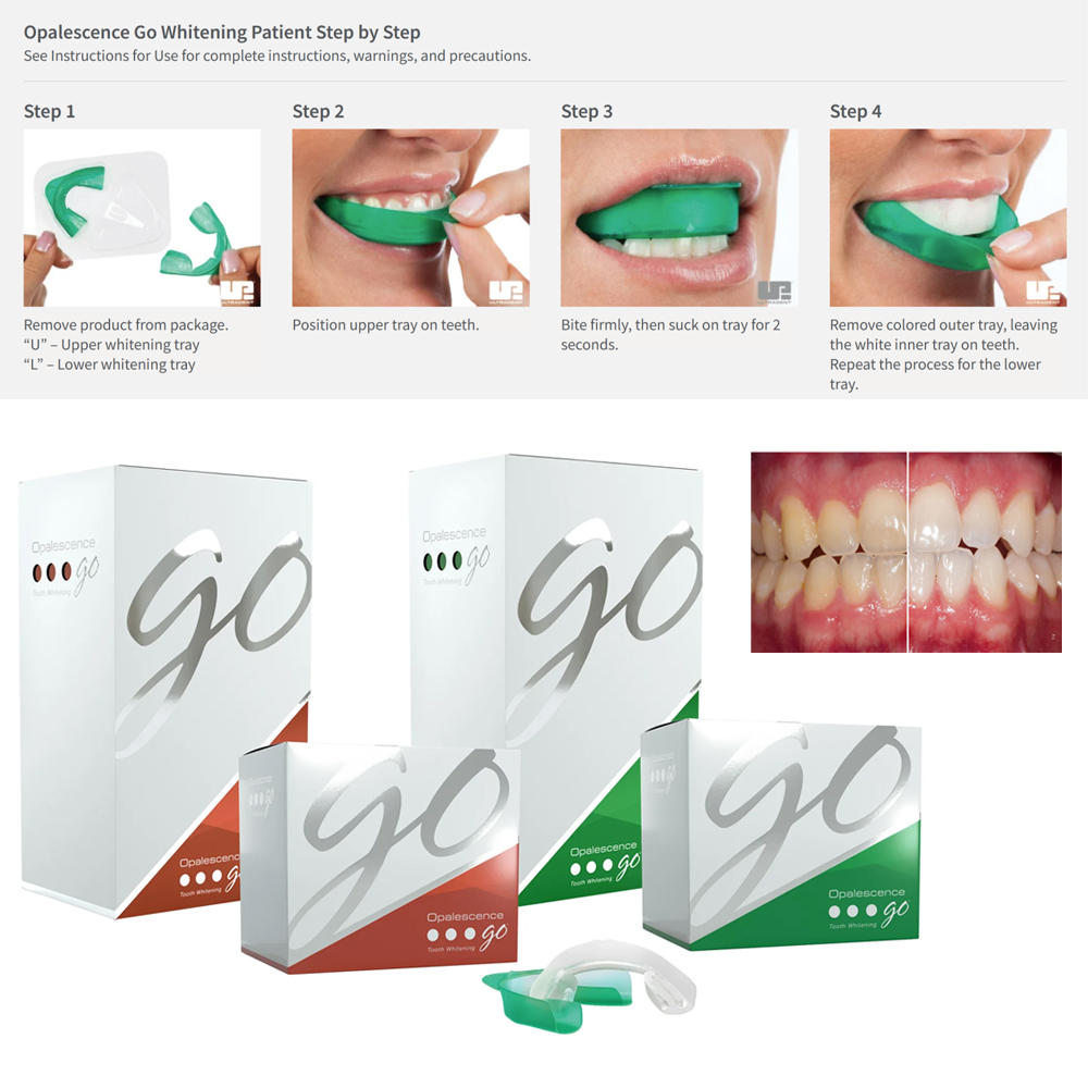 Opalescence Go Teeth Whitening - đánh giá và giá Teeth Whitening At Home Kit