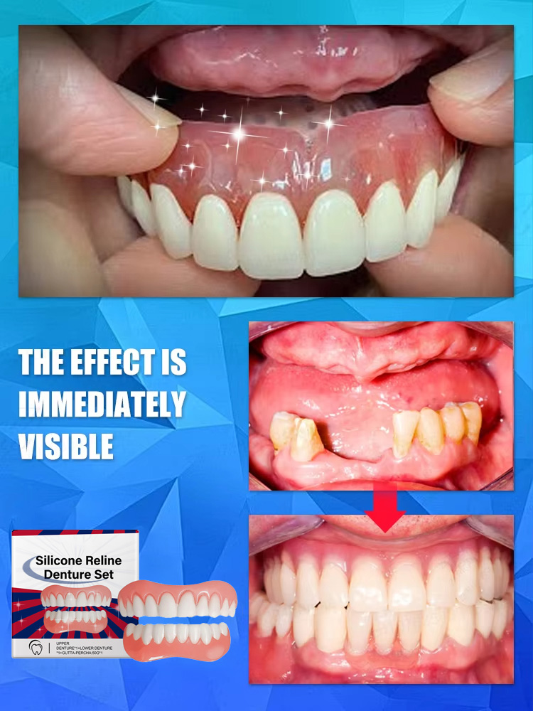 False Teeth Silicone Upper Low - đánh giá và giá Teeth Whitening With Braces