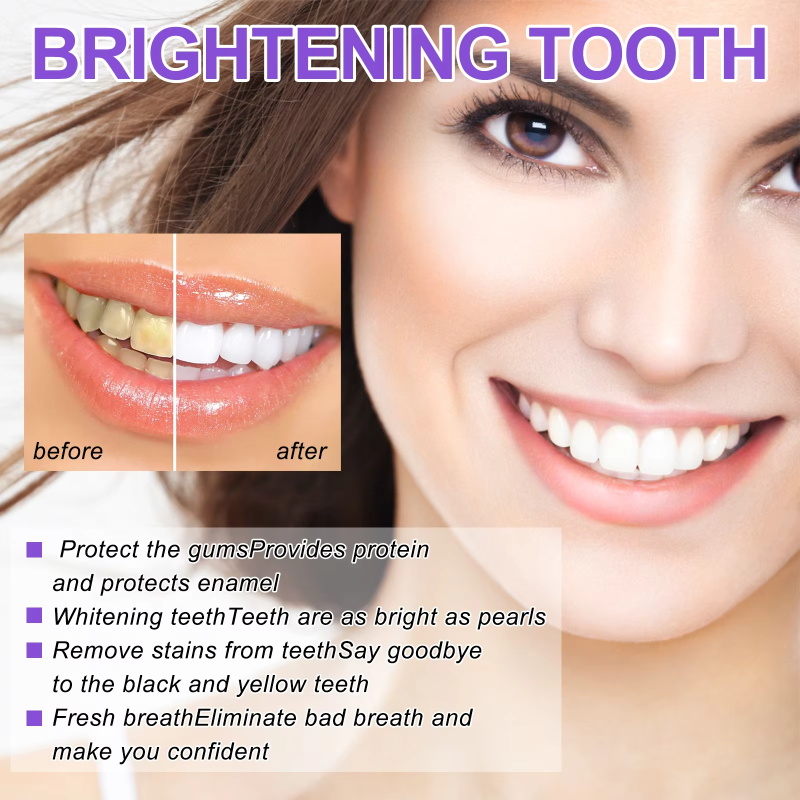 Teeth Cleansing Whitening Toot - đánh giá và giá Teeth Whitening In Korea