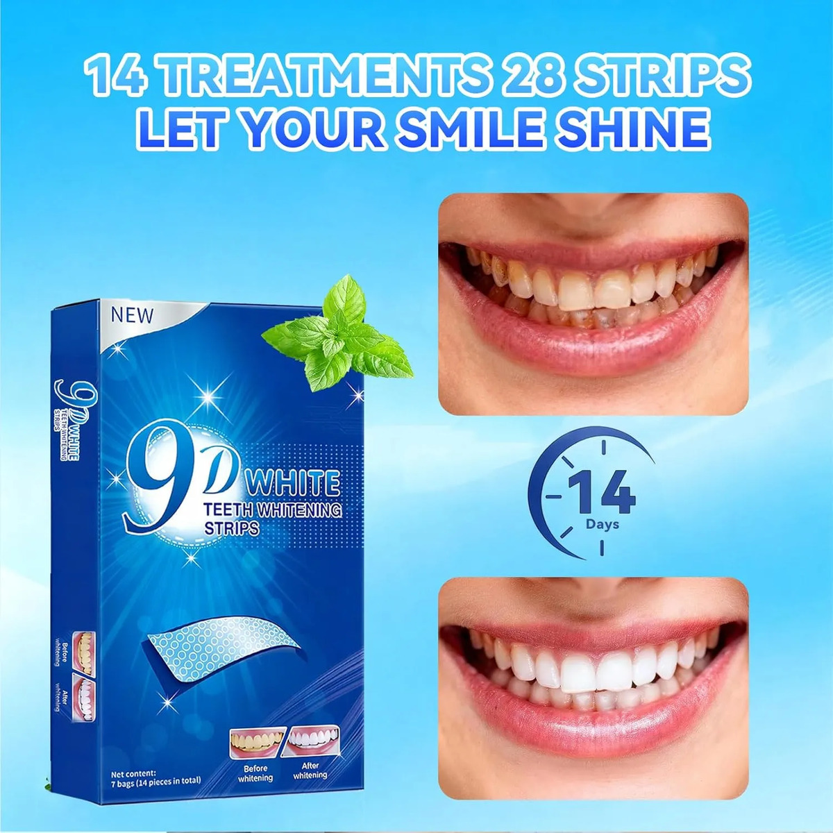 Teeth Whitening Strips - 9D Te - đánh giá và giá Teeth Whitening Effects