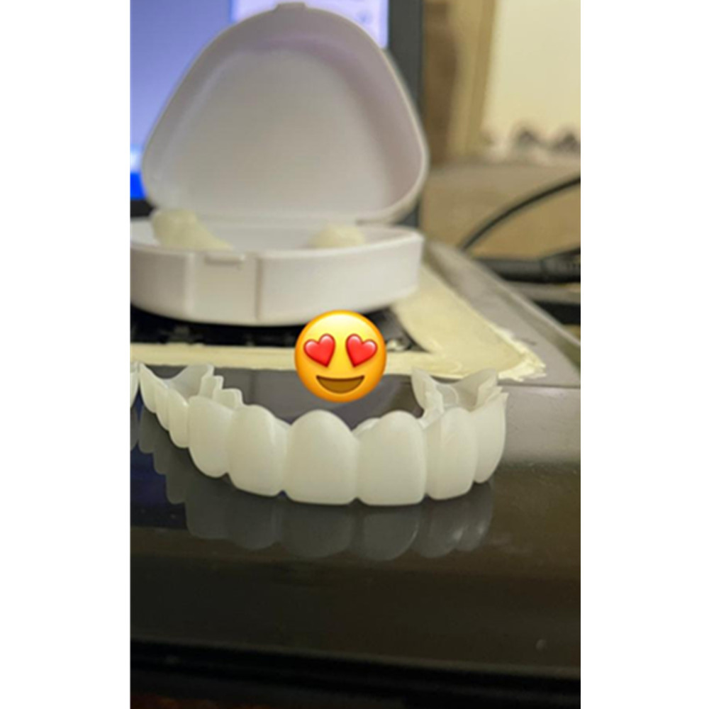 On Smile Dental Upper Lower Fa - đánh giá và giá Teeth Whitening With Braces
