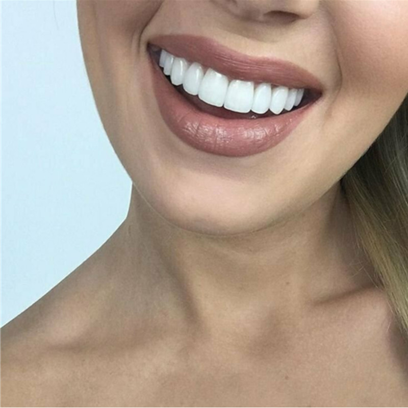 On Smile Dental Upper Lower Fa - đánh giá và giá Teeth Whitening With Braces