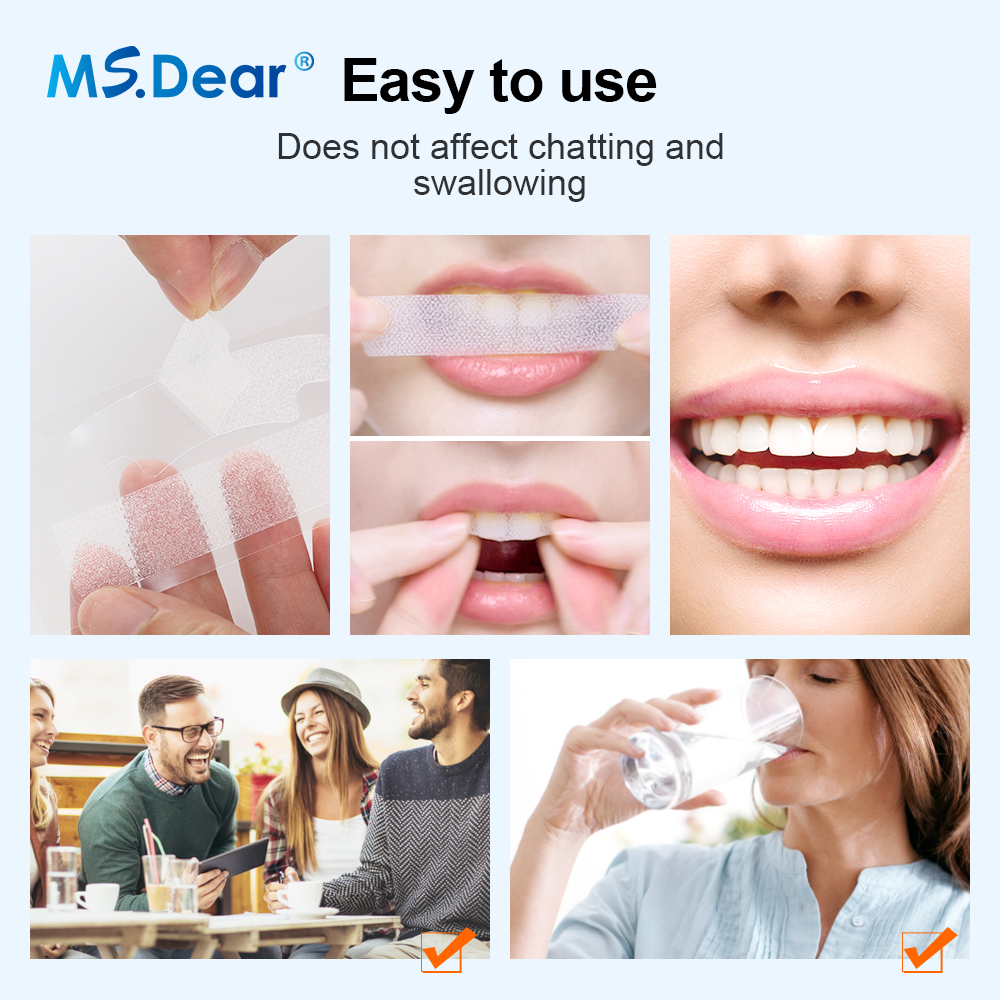 5D Whitening Teeth Stickers Wh - đánh giá và giá Teeth Whitening Effects