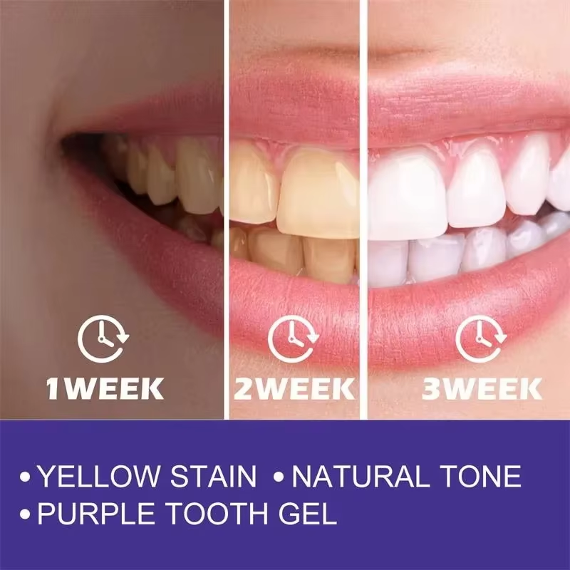 Teeth Cleansing Whitening Toot - đánh giá và giá Teeth Whitening In Korea